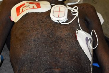 uppäten av vägglöss